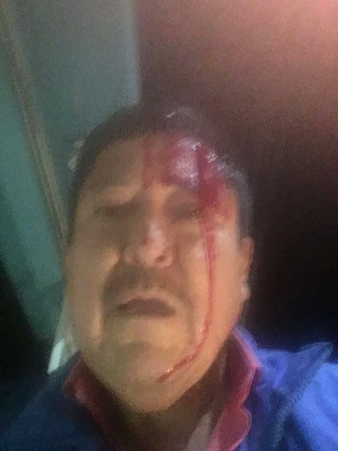 fotografía de redes