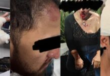 Denuncian agresiones contra personas trans y periodistas durante protesta en alcaldía Cuauhtémoc Herides en manifestación en alcaldía Cuauhtémoc por ataque de trabajadores de la demarcación en protesta trans.